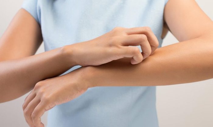 آلرژی به محصولات مراقبتی