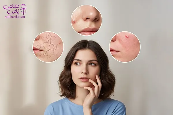 تشخیص نوع پوست