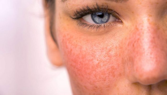 نگاهی علمی به ترکیبات موثر محصولات مراقبتی