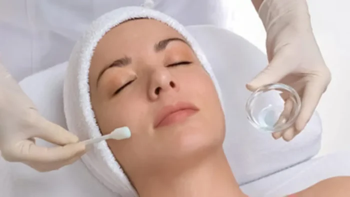 اسید تراپی چیست؟ معرفی ۱۲ اسید موثر برای جوانسازی پوست و درمان آکنه