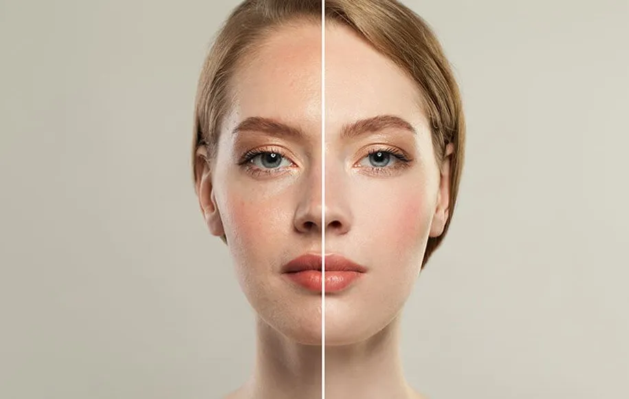 تاثیر استرس بر پوست و روش‌های کنترل