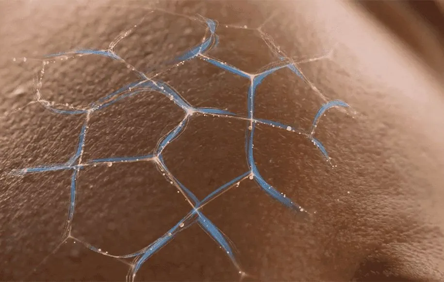 سرامیدها و پوست