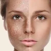 چگونه محصولات مراقبت از پوست با لک‌های تیره مبارزه می‌کنند؟